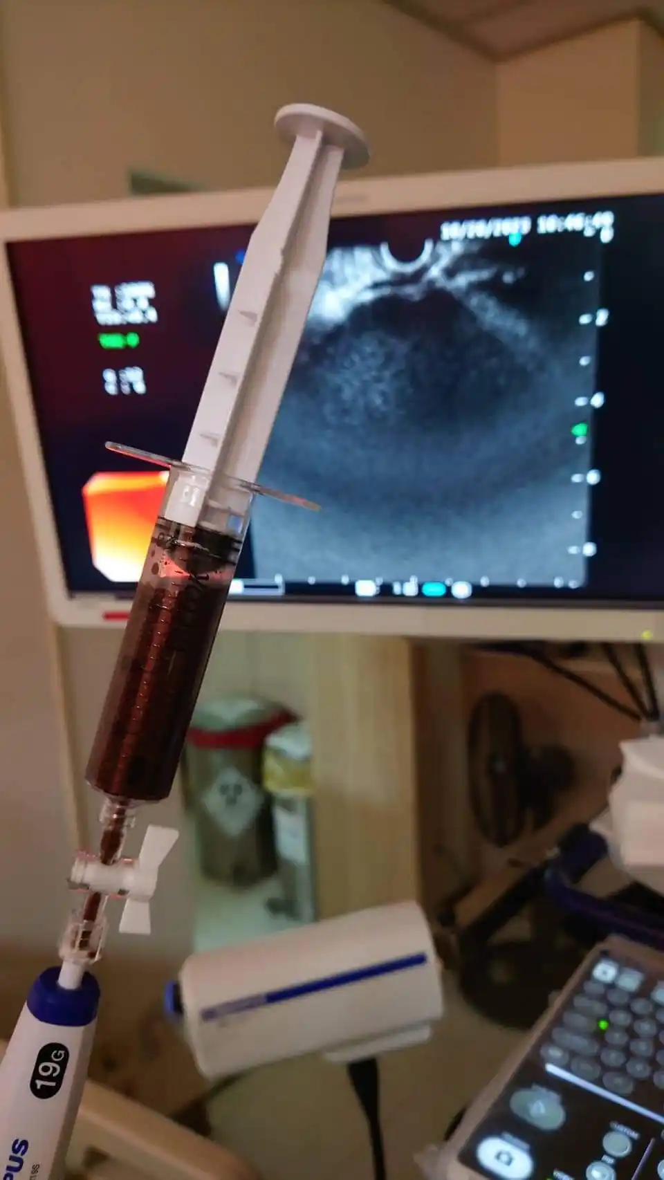 Ecoendoscopio de alta tecnología