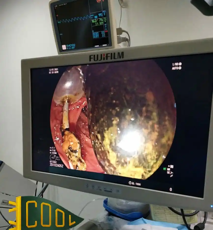 Equipamiento para CPRE de última generación